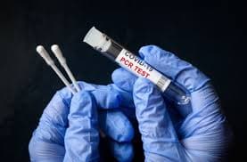 Covid-19. 30.000 Fcfa désormais pour un test Pcr