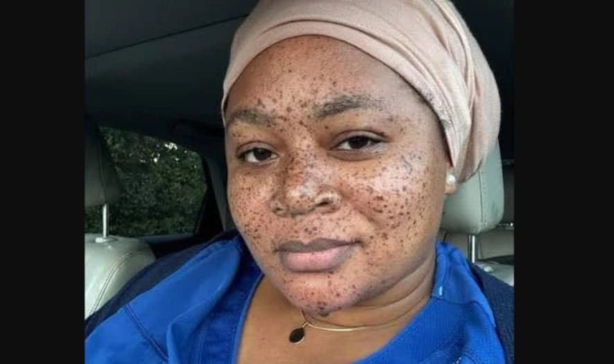 Laura Kheokienda, infirmière camerounaise, tuée par un arbre aux États-Unis