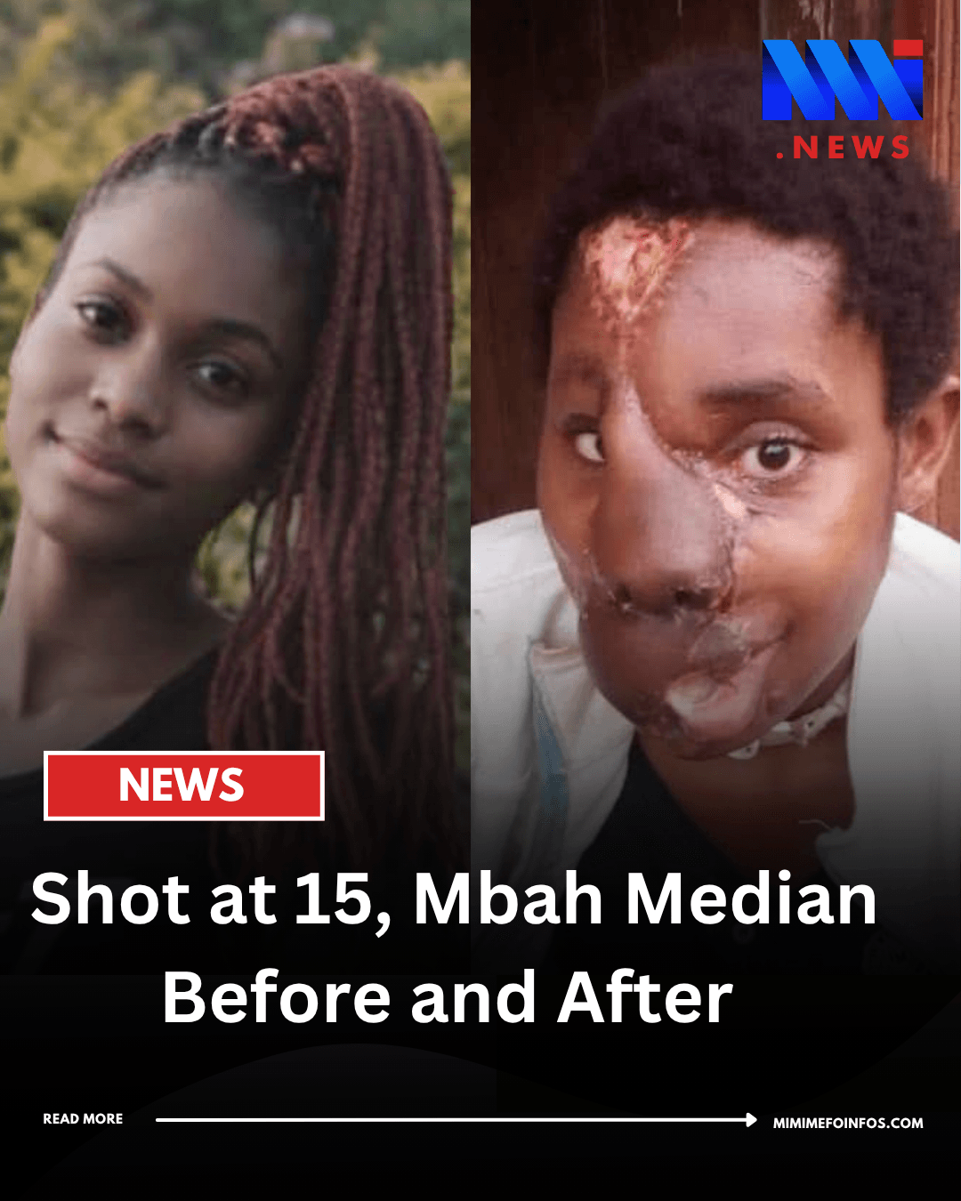 Shot in the Face at 15, Bah Median Still Dreams of Becoming a Doctor