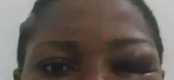 Yaoundé : une jeune femme accuse son compagnon de l’avoir battue pour 70 000 FCFA